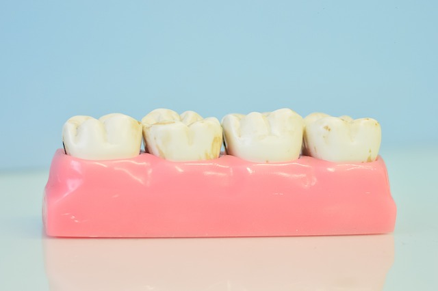 Gengiva Sangrando? Entenda a Periodontia e Como Cuidar da Saúde da Sua Gengiva em Sorocaba.