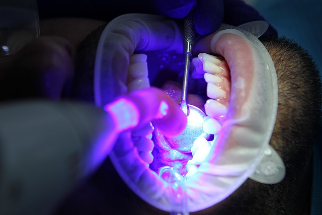 Sorriso Amarelo? Descubra o Melhor Clareamento Dental em Sorocaba Para Você.